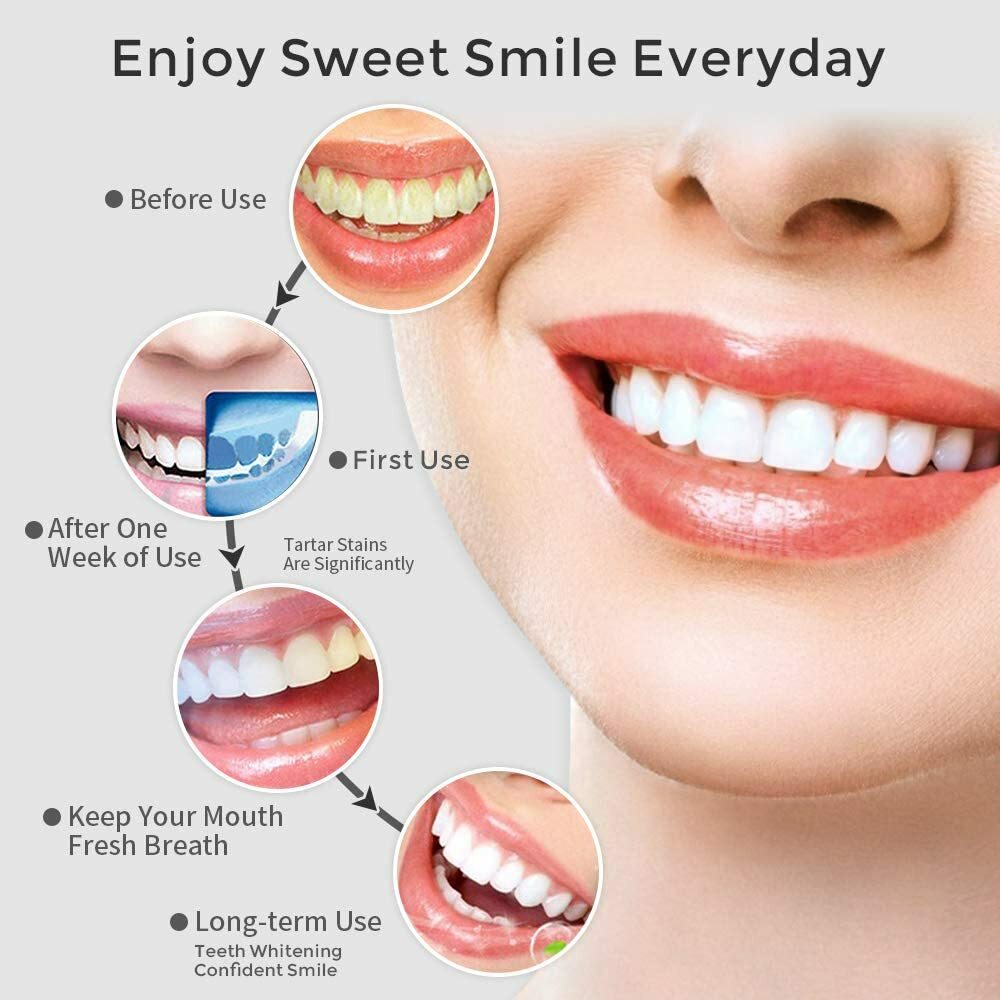 Cordless Water Flosser Dental Oral Irrigator Travel Teeth Cleaner Floss Pick