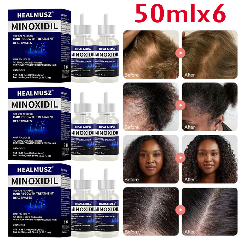 6 Pack Minoxidil 5% Extra Strength Men Hair Regrowth Treatment 6 Month Supply