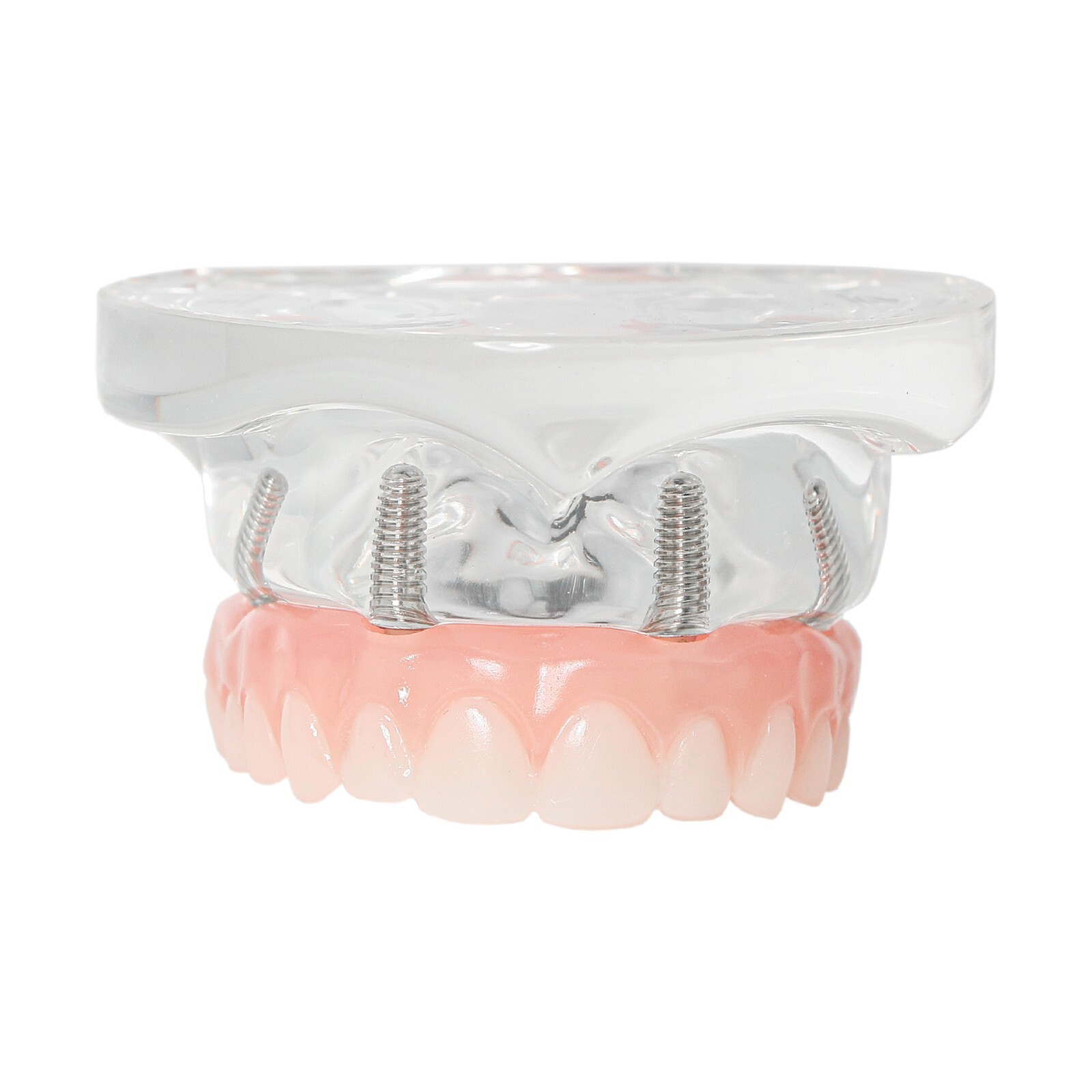 US Dental Overdenture/Implant/Orthodontic Typodont Ortho Training Teaching Model