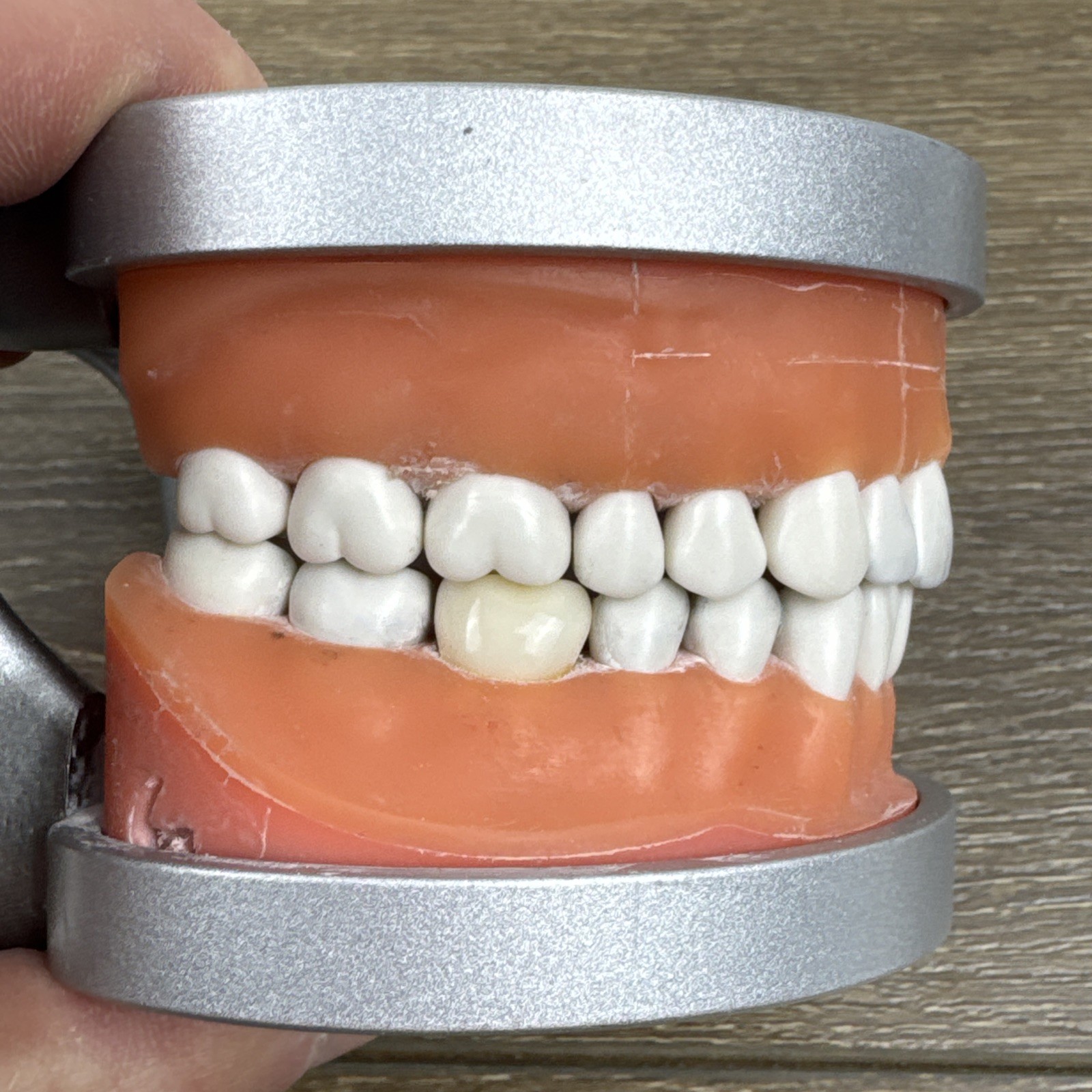 Acadental ModuPRO MP_R320 Restoration Typodont & Case WREB CDCA ADEX Teeth #54