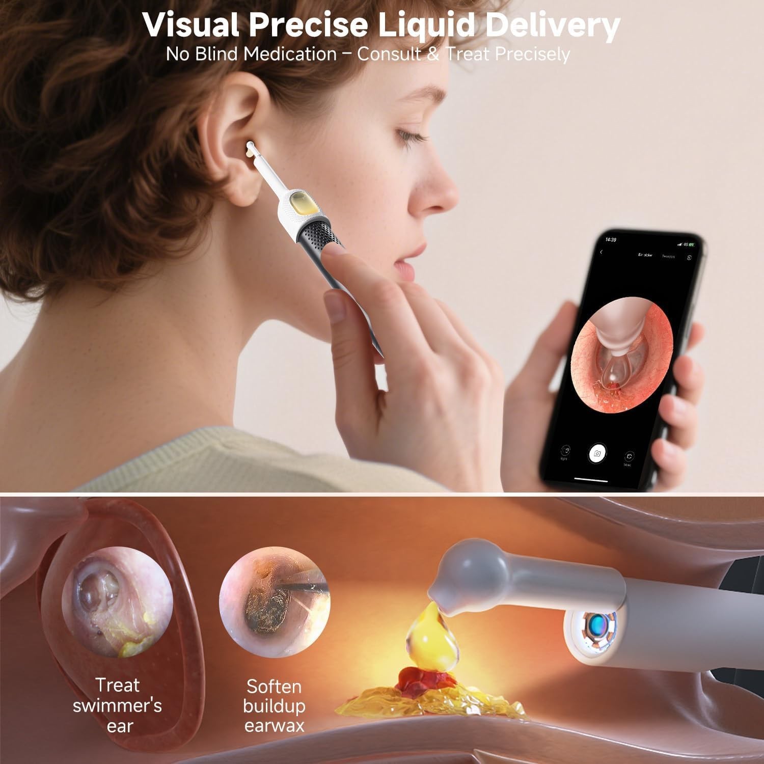 BEBIRD R1 Ultra Ear Wax Removal, Cleaner with 1 Count (Pack of 1), Black