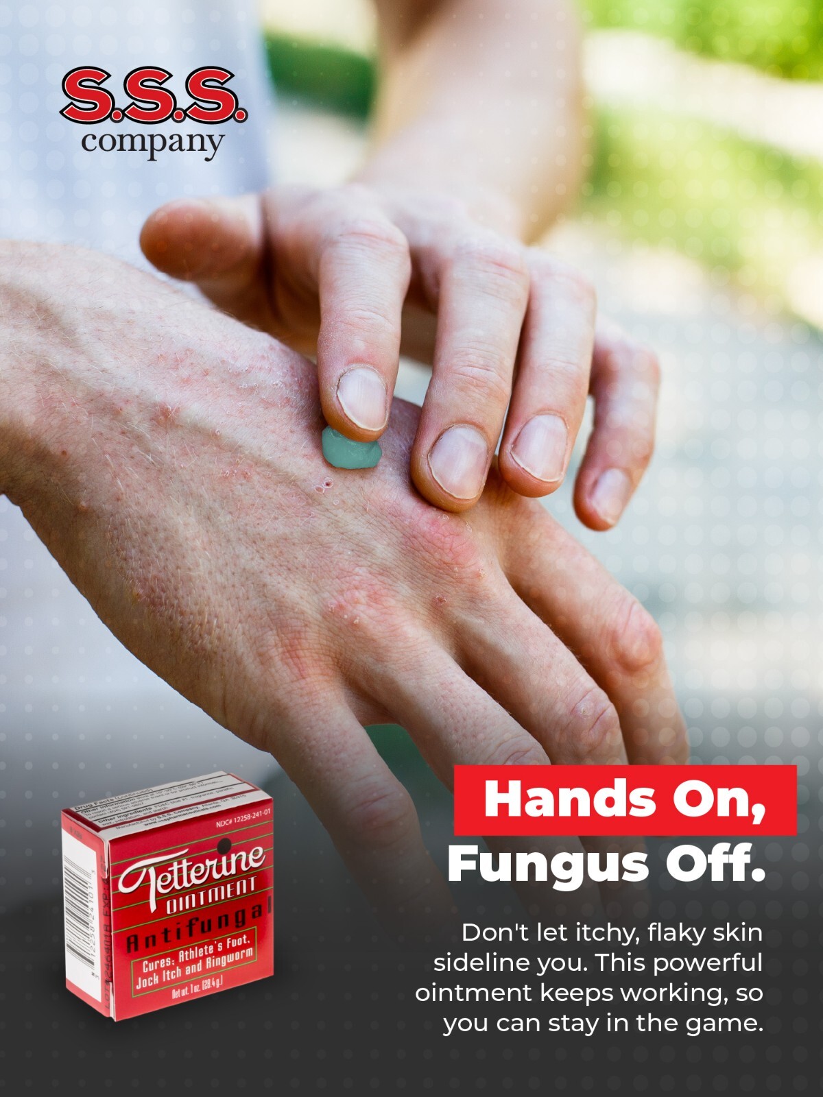 Tetterine Antifungal Salve for Athlete's Foot, Jock Itch, Ringworm - 1 oz