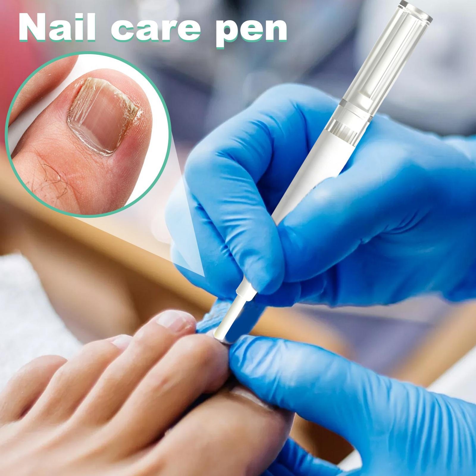 3PCS Orville Nail Fungus Pen Anti Fungus Infection Nail Care Repair Pen Toenail