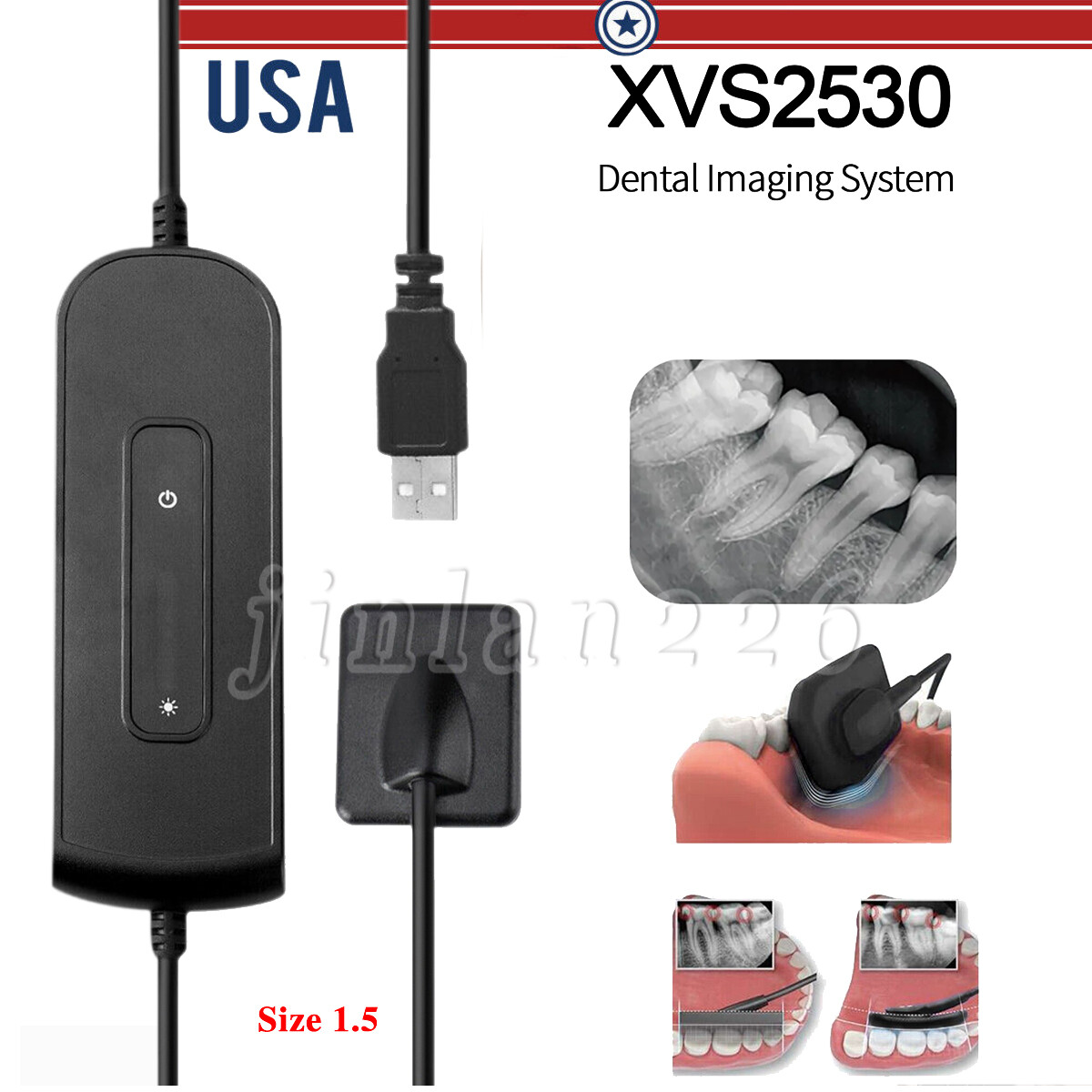 Sensor Dental RVG X-ray Sensor Digital Imaging System 1.5M Holder