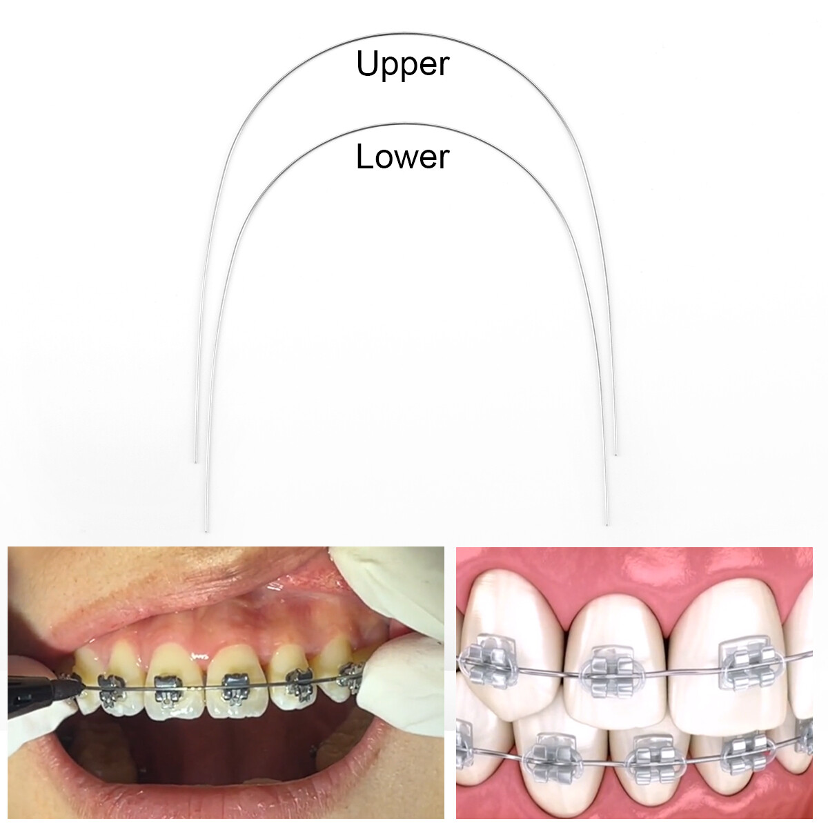 AZDENT Dental Orthodontic Super Elastic Niti Round Arch Wire Nature/Ovoid Form