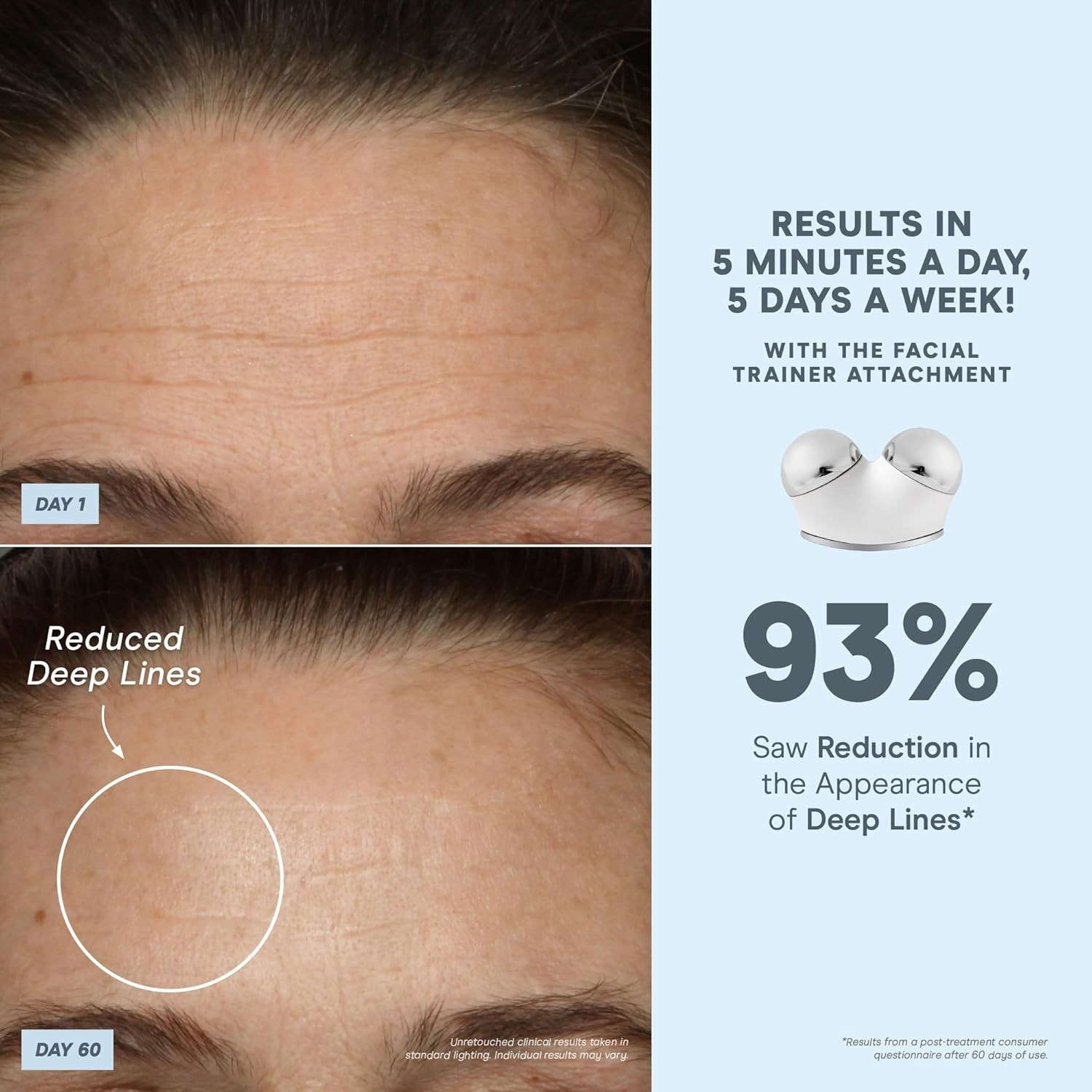 NuFACE Trinity+ Microcurrent Facial Device Kit - FDA Cleared Face Sculpting & Ne