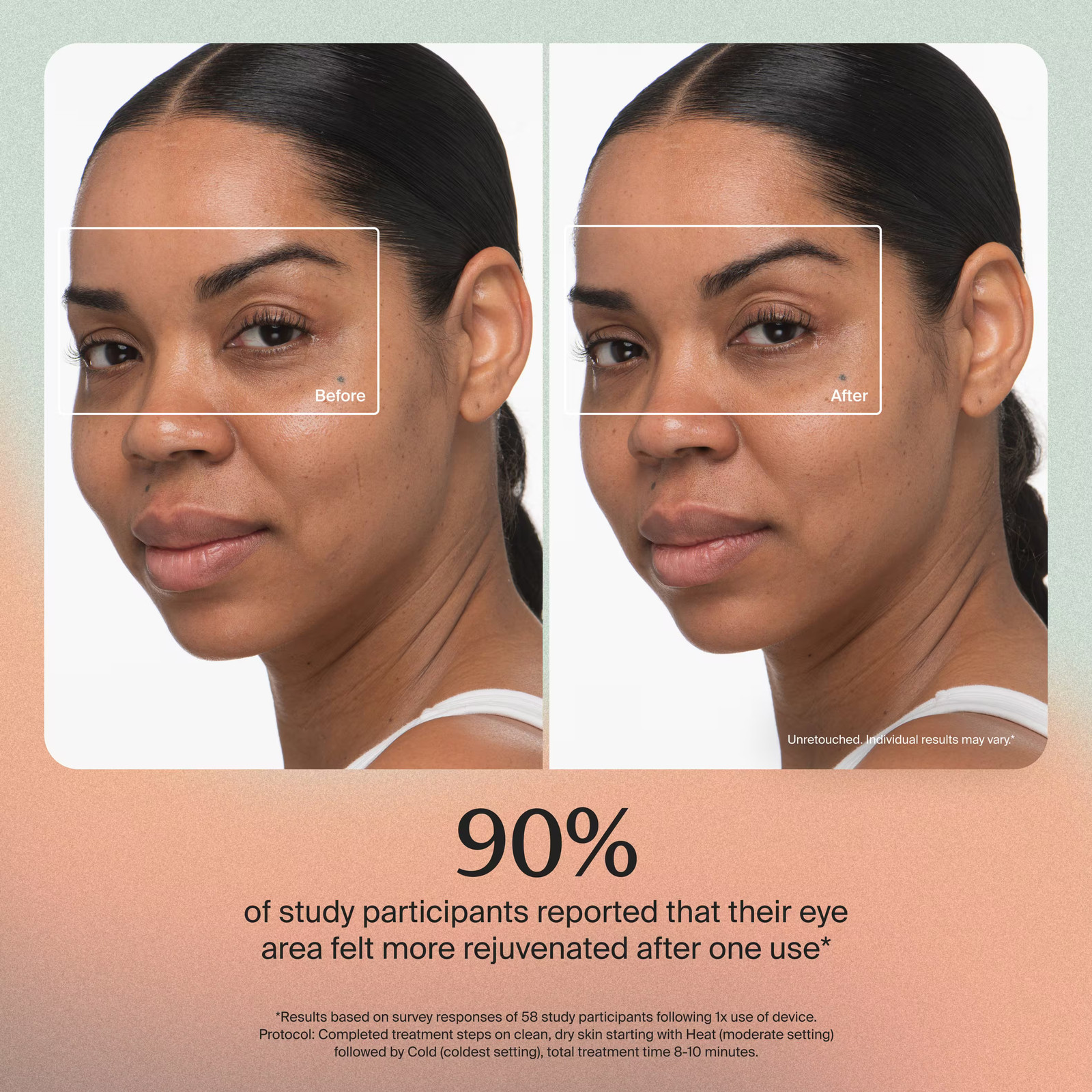 Therabody - TheraFace Depuffing Wand - White