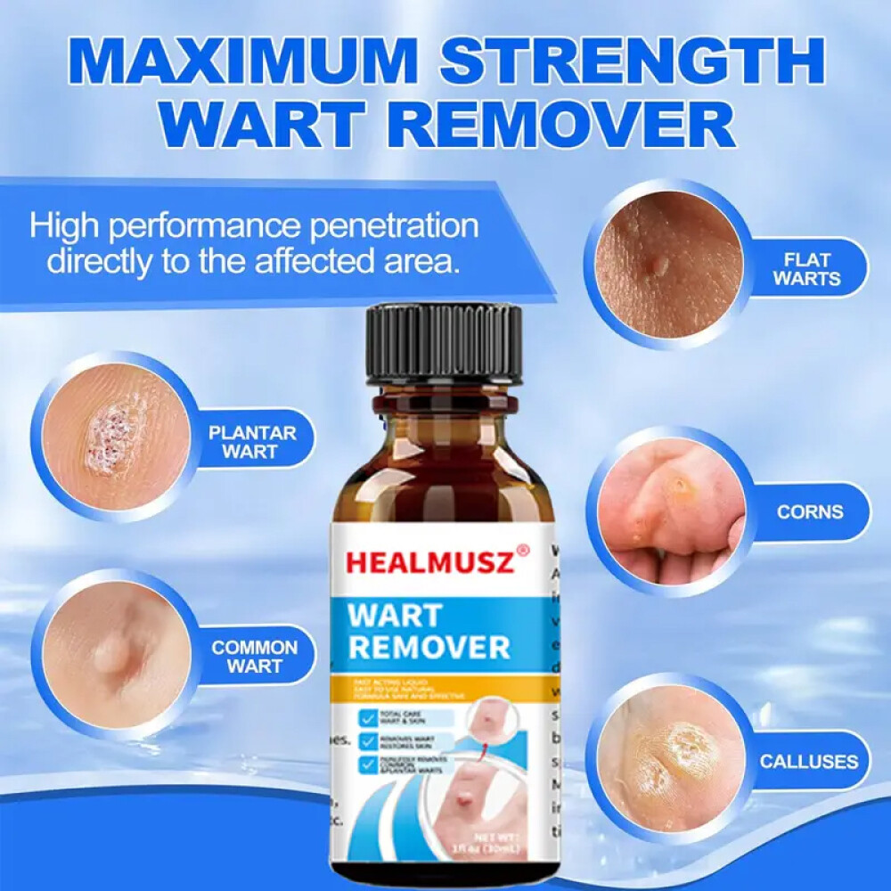 Wart Remover Liquid Skin Tag Mole Remover Eliminate Feet Corn Wart Remove Liquid