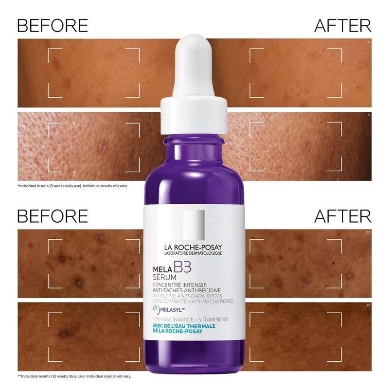 'La-Roche-Posay' Mela B3 Dark Spot Serum Melasyl + Niacinamide 30ml