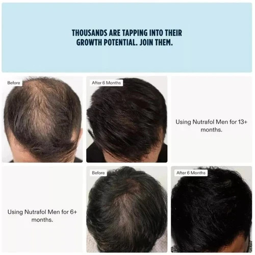 Men Hair Growth Nutraceuticals Dietary Supplement 120 Capsules EXPIR 2027