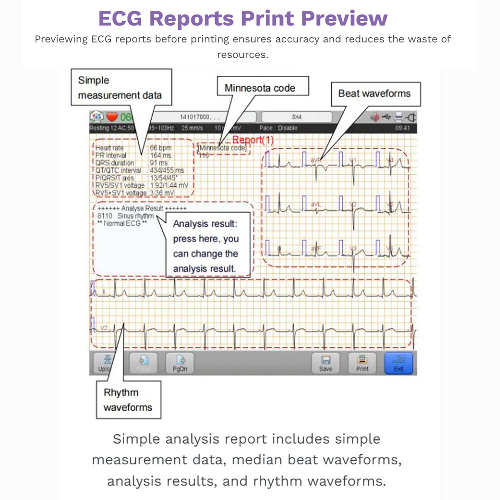 Biocare iE6 12 lead 6 channel ECG Machine Touchscreen with interpretation FDA US