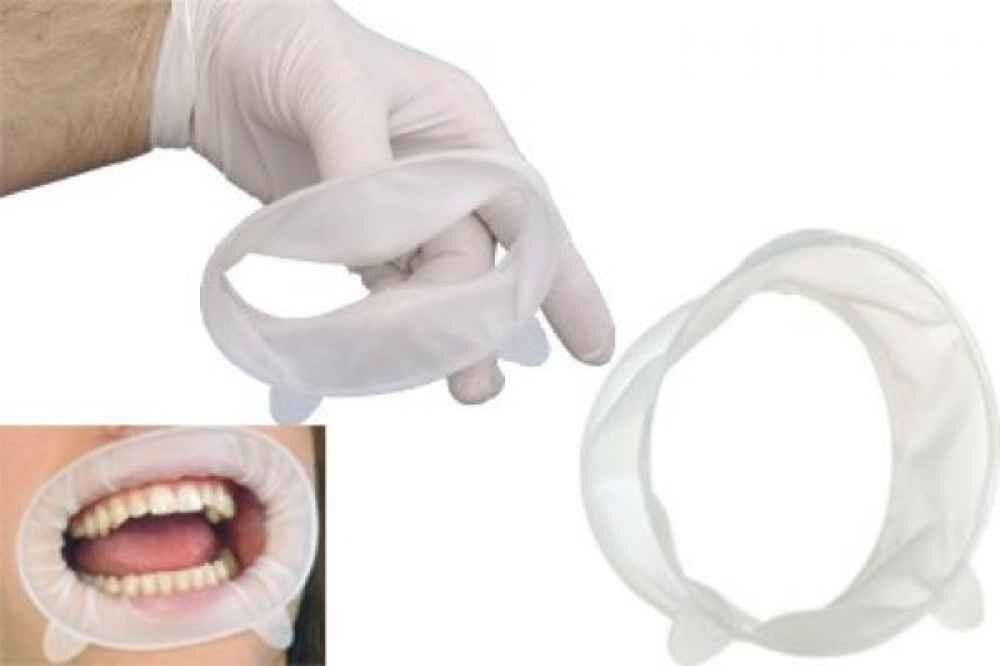 4 x Ivoclar OPTRAGATE 3D Mouth Opener Cheek & Lip Retractor Small/Regular