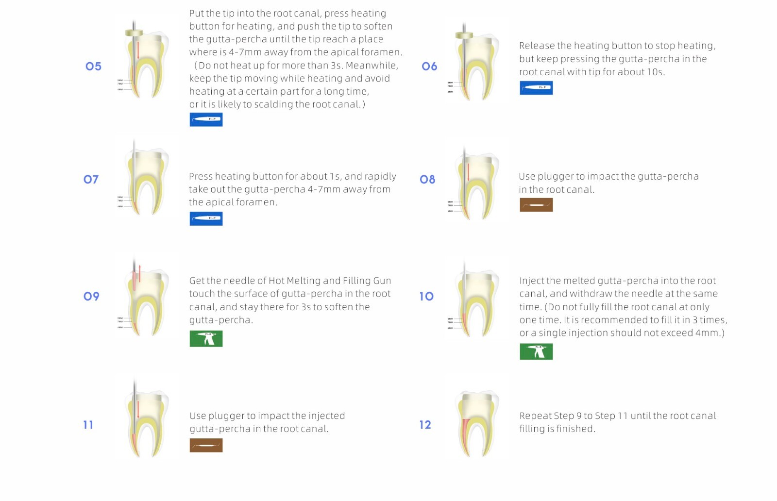 Original Woodpecker Endo Cordless Gutta-Percha Obturation System Gun Fi-G