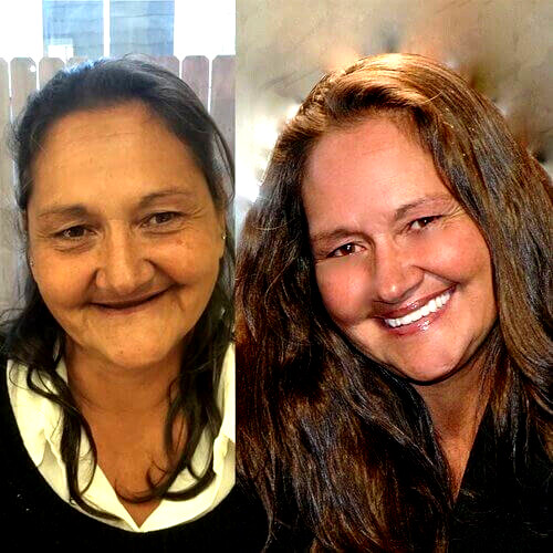 DIY DENTURE KIT Custom Dentures made at home FREE Priority Ship FULL PARTIAL