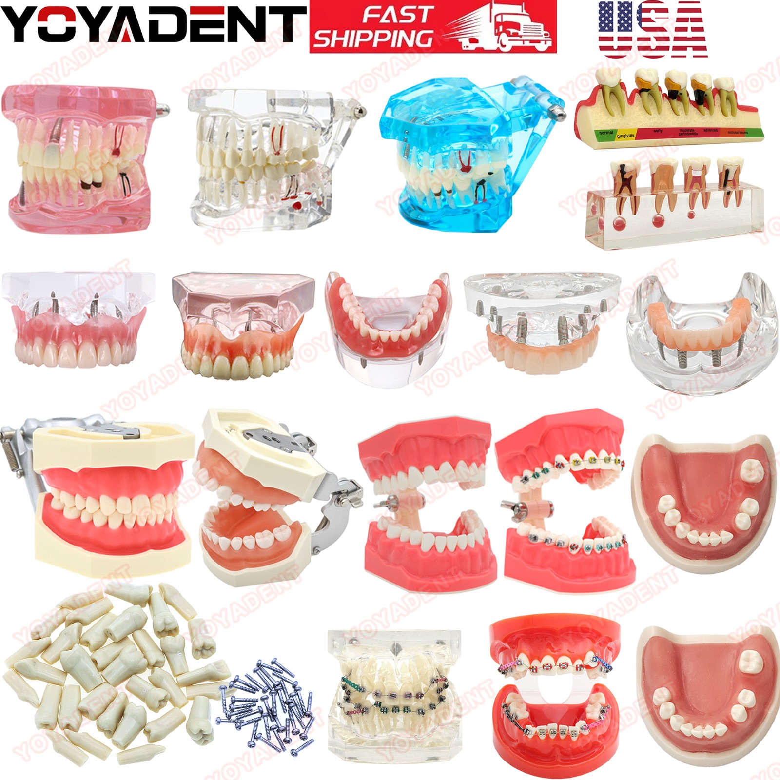 US Dental teeth Model Preparation Training Teaching Ortho Implant Typodont Demo