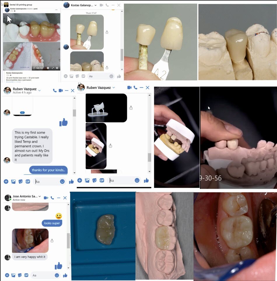 DLP SLA LCD 3d printer permenant crown - teeth resin ..