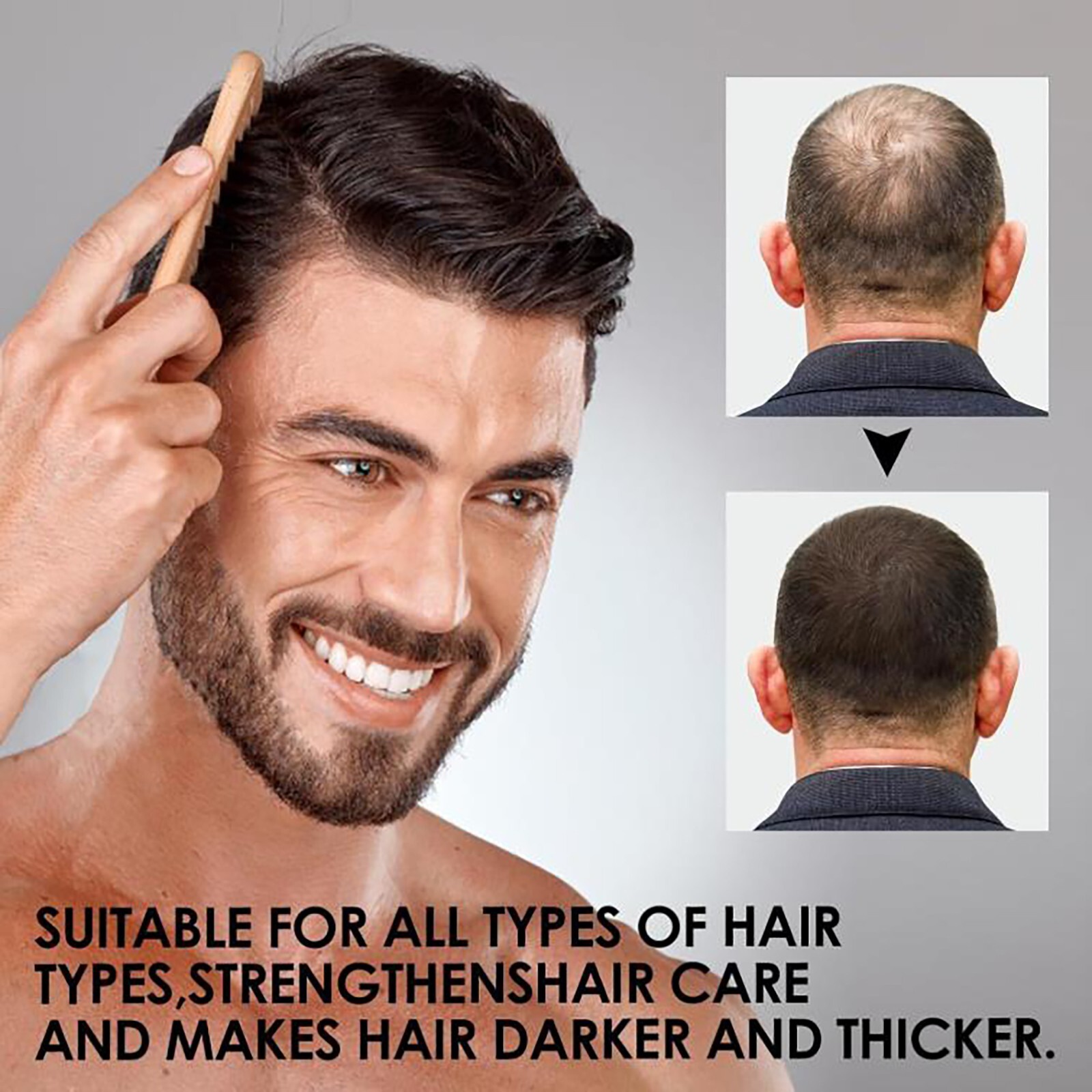 New Root Activator Shampoo SPARTAN Hair Loss Shampoo Root Activator ( 200ml )