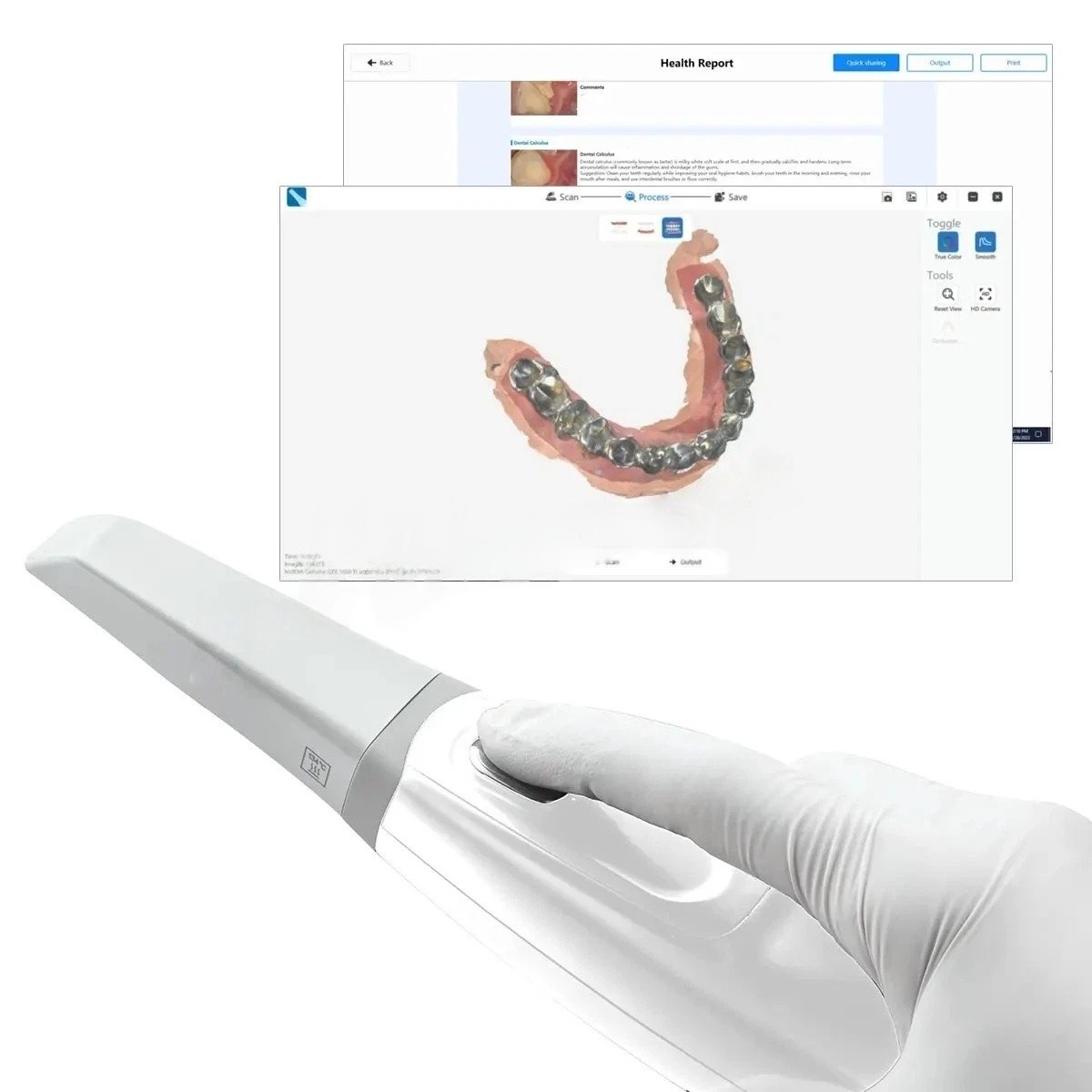 Dental Intra-oral 3D Scanner AI 3D Aoralscan with Free Software