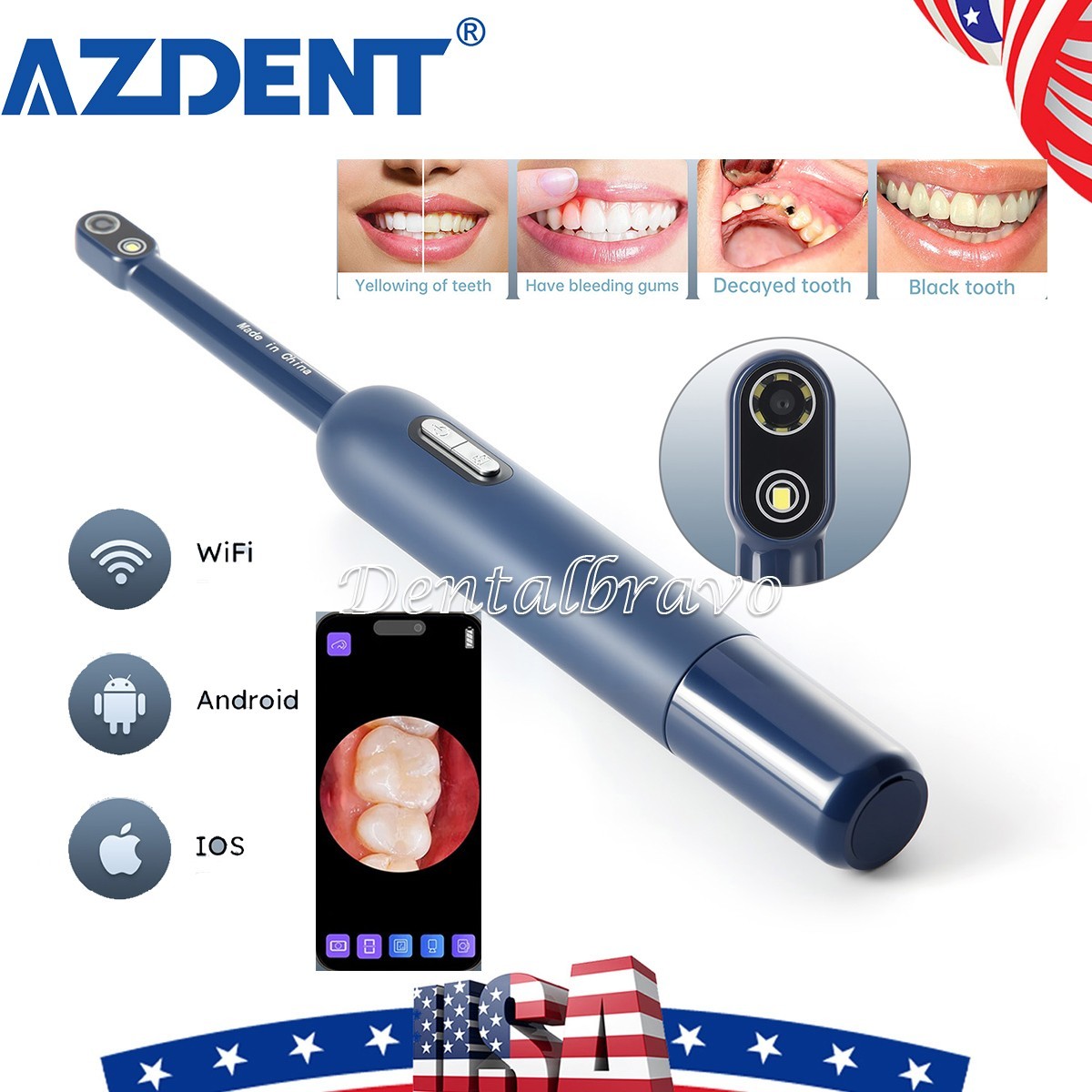 Dental Intraoral Camera 7LED light Wifi Digital Imaging Intra Oral HD Camera