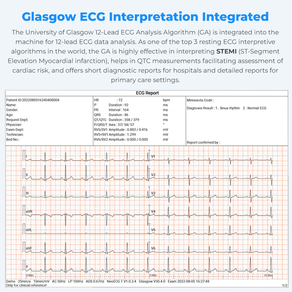 NEW 6/12-lead Electrocardiograph ECG EKG Machine + Glasgow ECG Interpretation