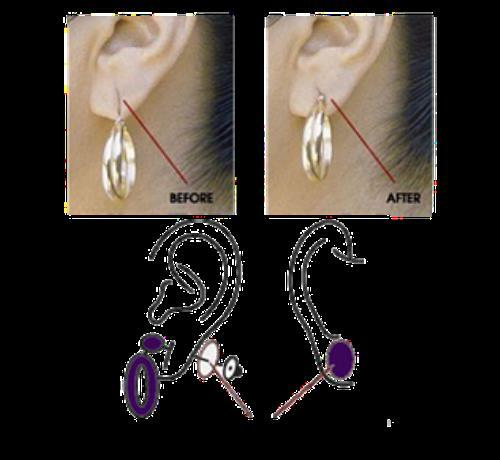 Lobe Miracle Ear Lobe Support Patches, 60 Count