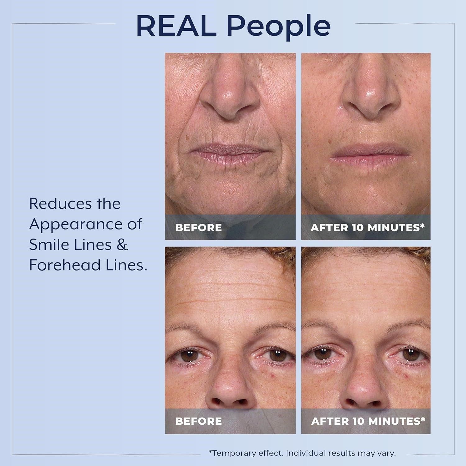 Plexaderm Rapid Reduction Eye Serum - Visibly Reduces Under-Eye Bags, Wrinkles🔥