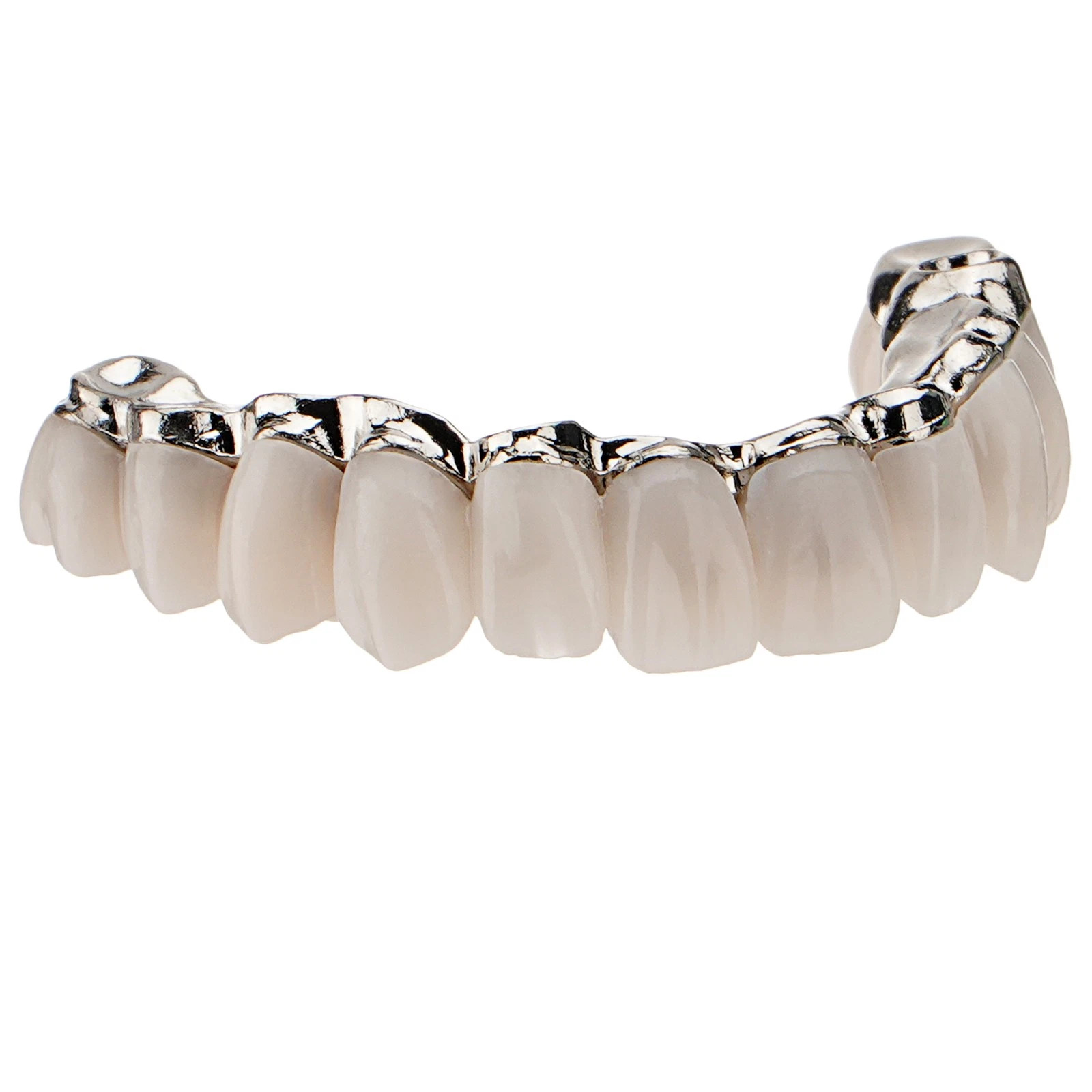 Dental All-on-4 Overdenture Model Dental Upper Jaw Implants Restoration 4 Screws