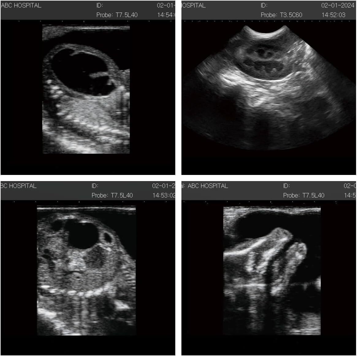 VET Veterinary Portable Ultrasound Scanner Machine Sheep Goat Pig Convex Probe
