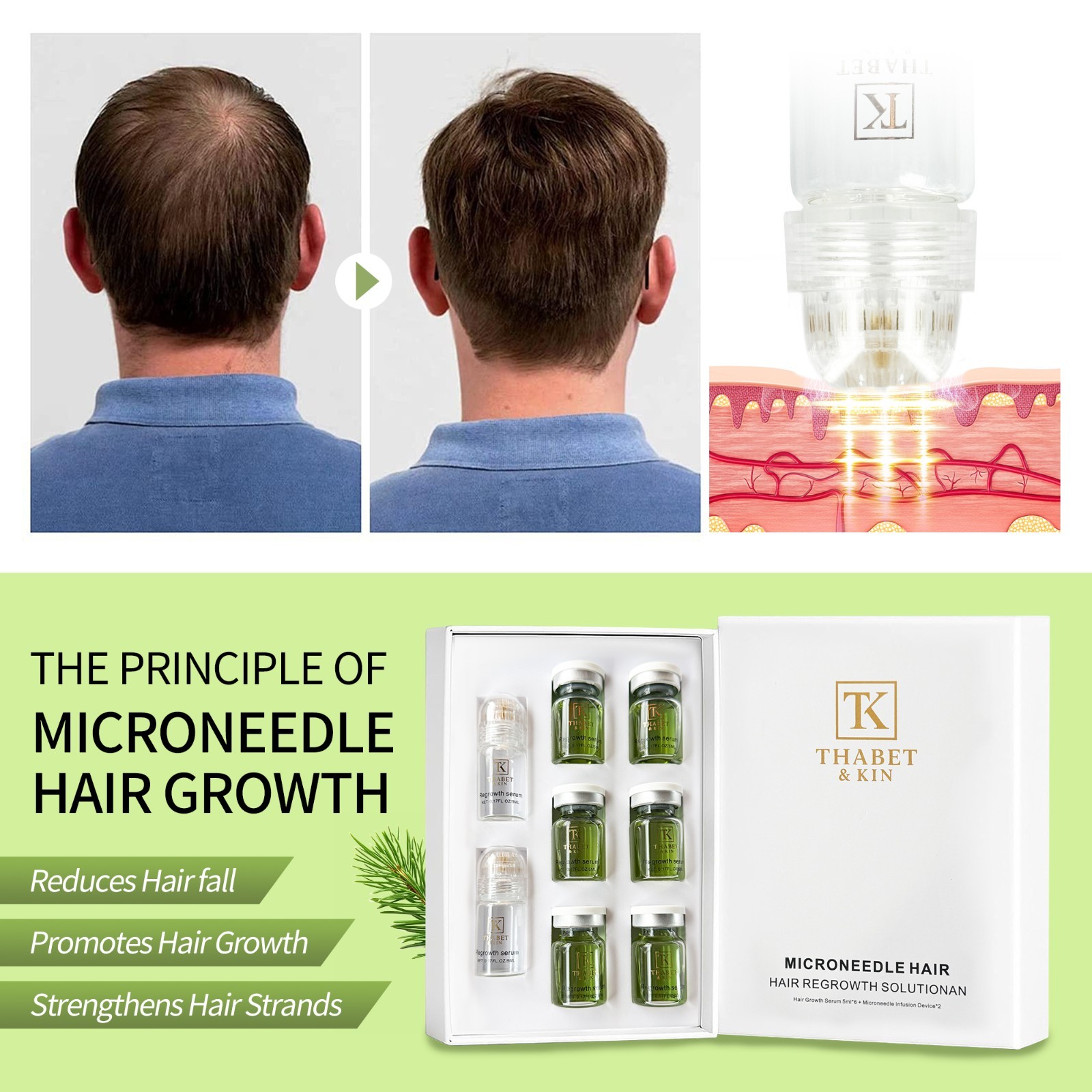 Infuse Hair Regrowth System, Advanced Hair Growth Treatment USA Brand FAST Ship