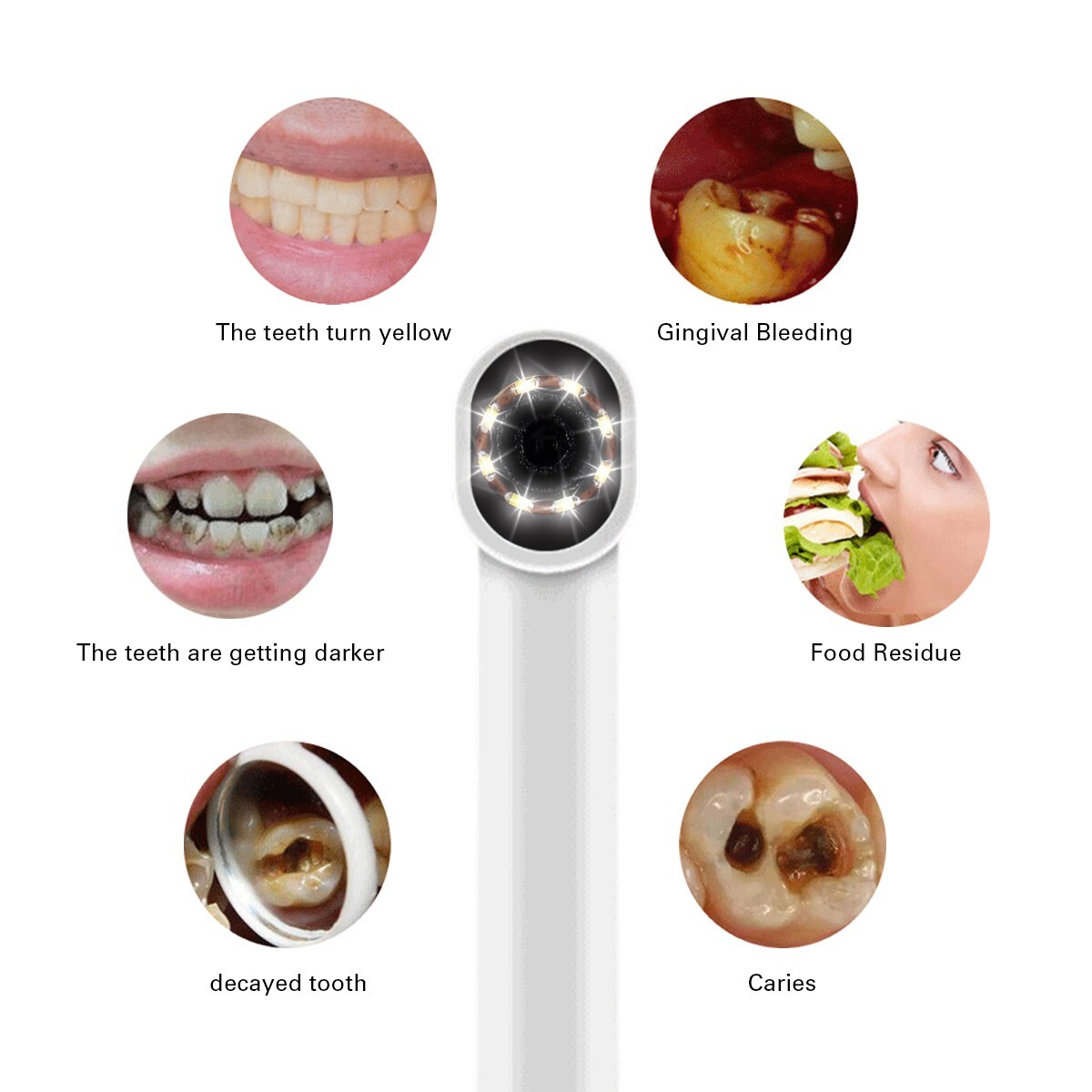 AZDENT Dental USB Imaging Intraoral Camera Real-time Video 8LED Light Endoscope