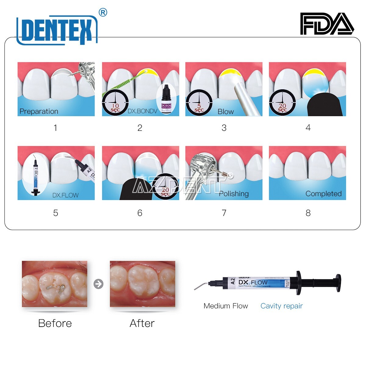 DENTEX Dental Light Cure Flowable Composite Resin Medium Flow Shade A2 3g/Pc