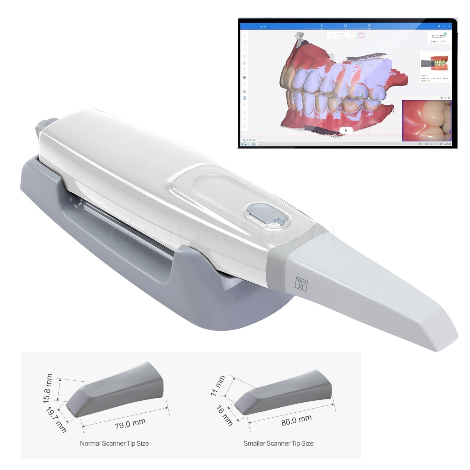 Dental Intraoral Scanner for CAD/CAM Restorative Dentistry