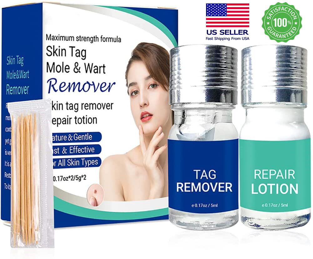 Skin Tag Remover and Repair Liquid Mole Corrector Wart Skintag Foot Corn removal