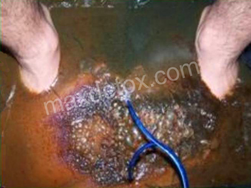 Ionic Balancer EXPRESS Detox Spa - FLASH SALE 35% off