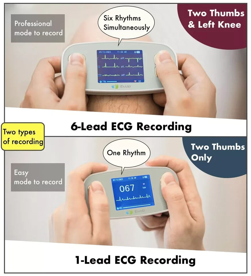 EMAY 6Leads Portable ECG Monitor Record ECG and Heart Rate in 6 Channels