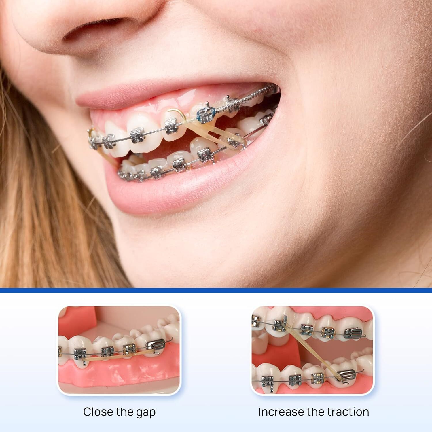 JMU Dental Orthodontic Elastics Intraoral Elastic Bands Latex Braces 100pcs/pk