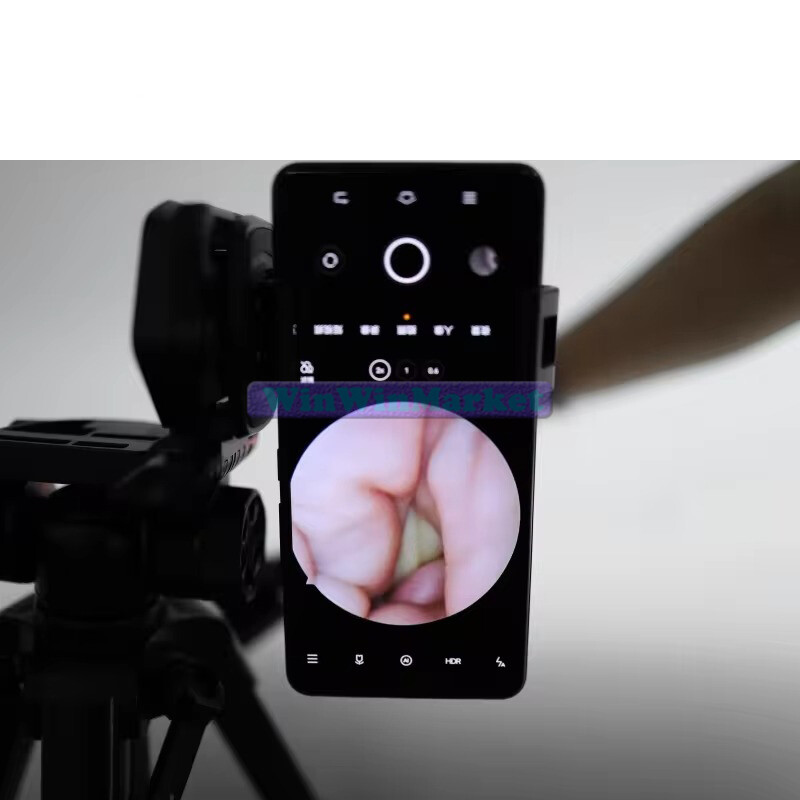 Surgical ENT Rigid Endoscope 0/30/70/90 Degree Sinuscope Otoscope Laryngoscope