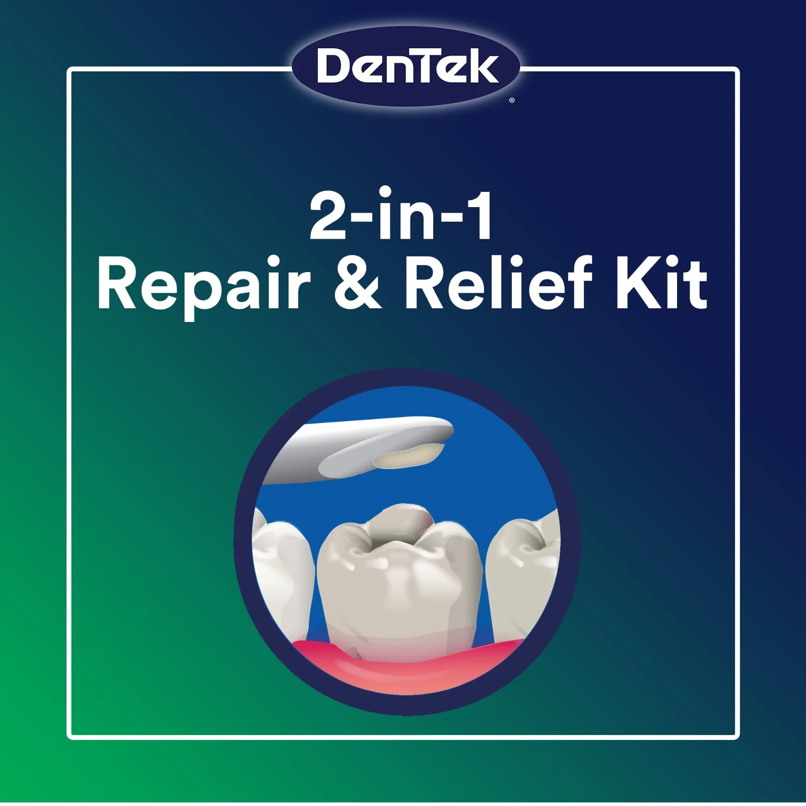 Dentek Temparin Max Advanced Dental Repair Kit, 13+ Repairs - Free Shipping
