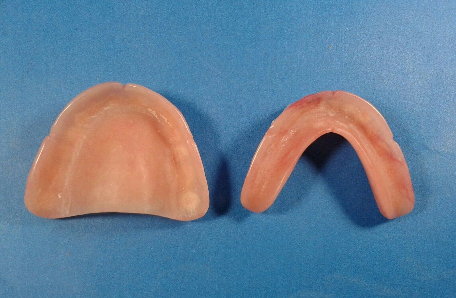 Dentures, set of false teeth with Hollywood bleach shade teeth