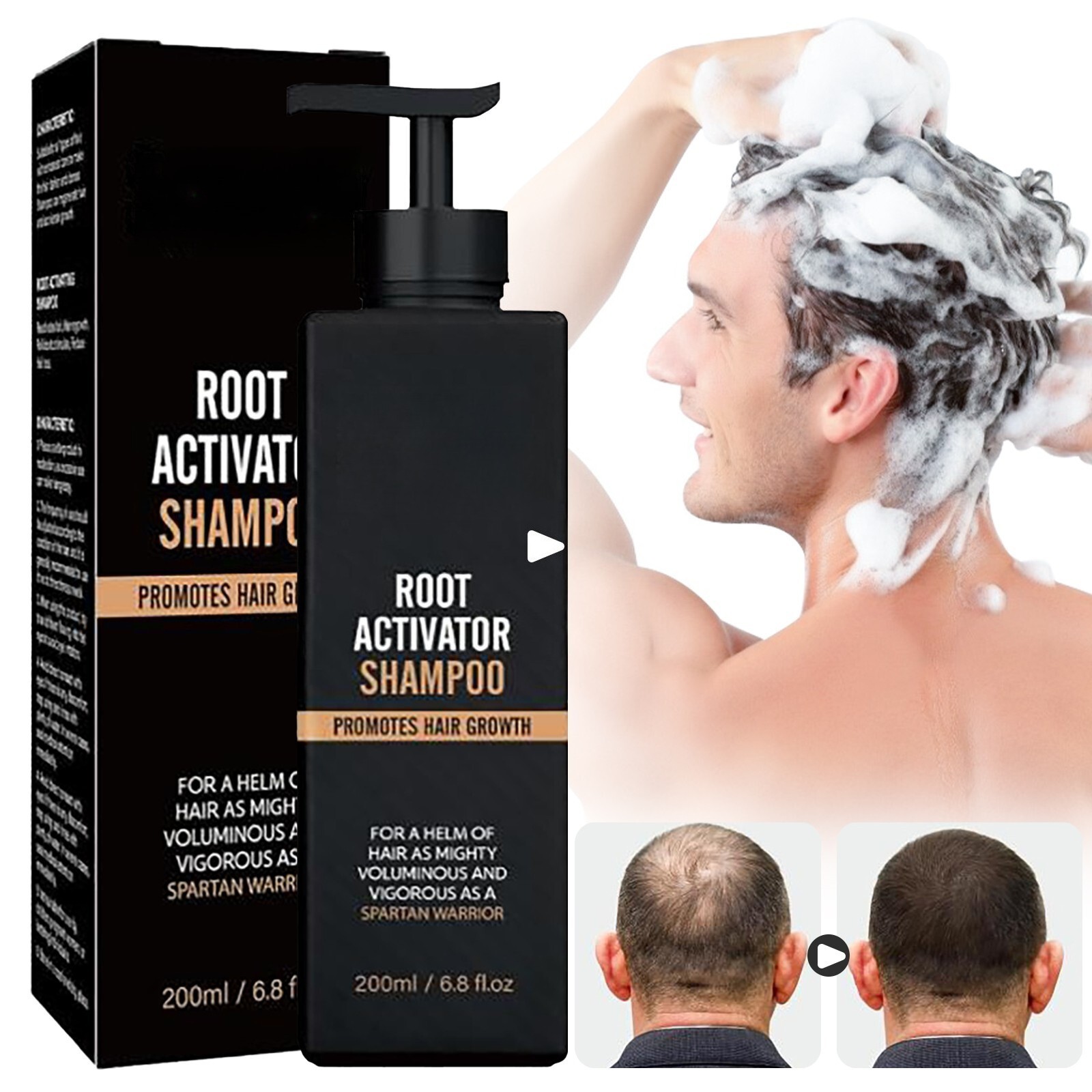 Root Activator Shampoo SPARTAN Hair Loss Shampoo Root Activator ( 200ml ) USA