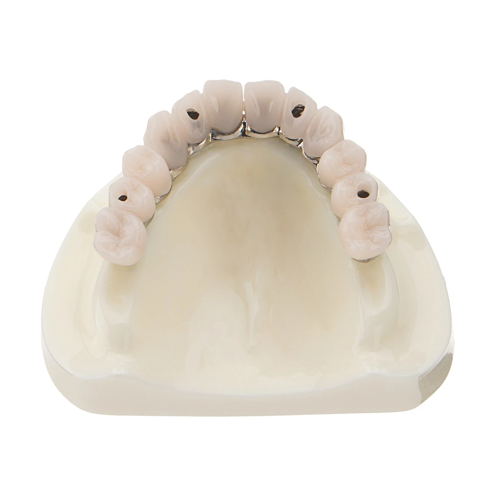 Dental All-on-4 Overdenture Model Dental Upper Jaw Implants Restoration 4 Screws