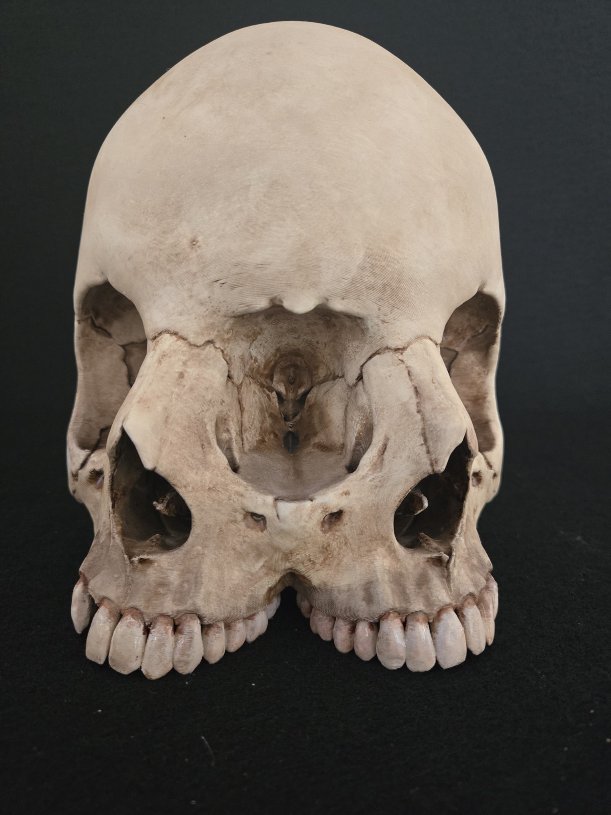 Human Skull - Triclops - Realistic Full Adult Size