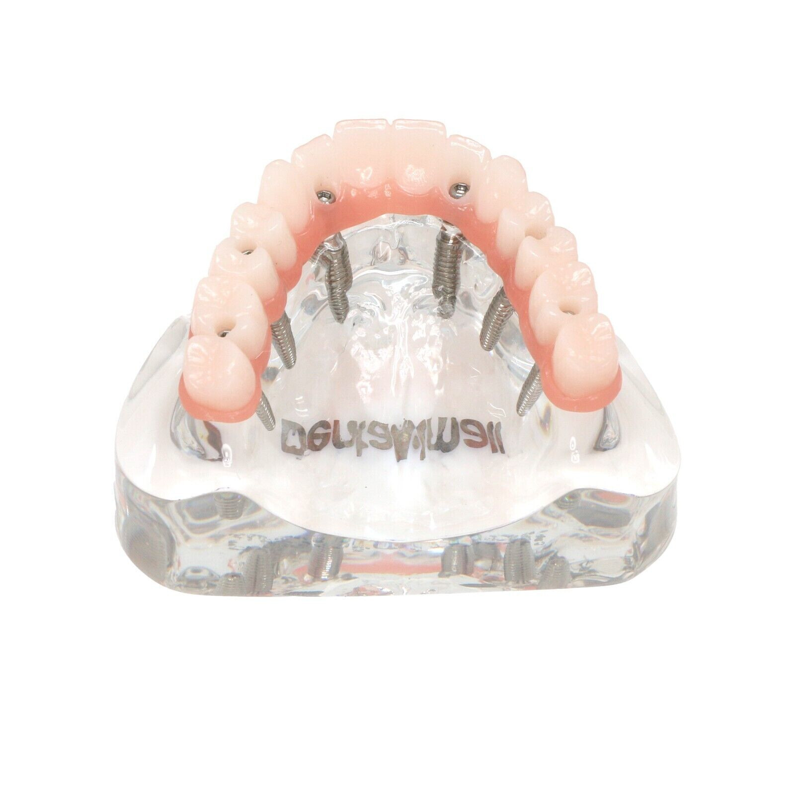 Dental All-On-6 Overdenture Implant Model Demo Upper Jaw 6 Screws Clear M6001-2