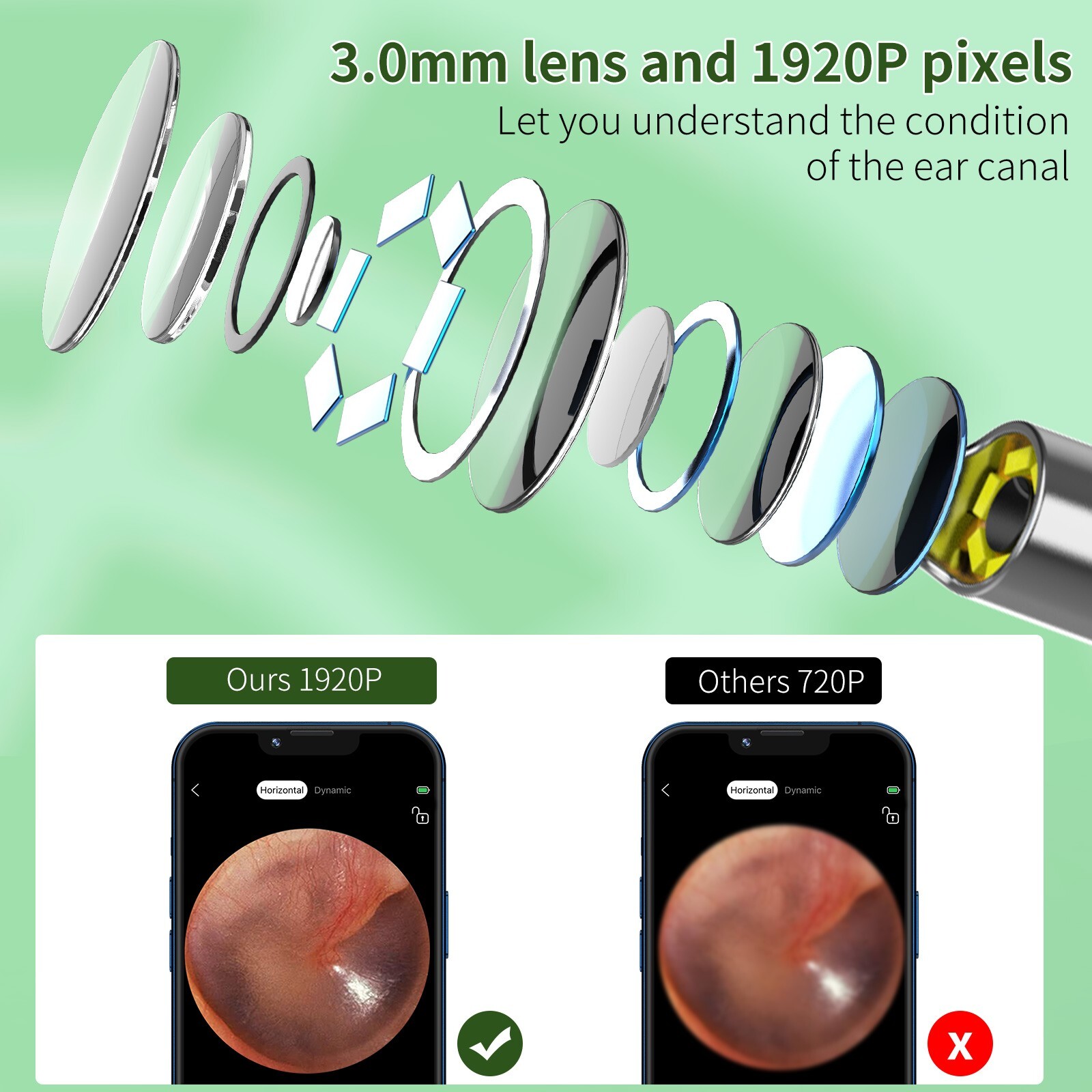 Ear Wax Removal Kit: 1920P HD Camera & 8-Pc Ear Set for iPhone, iPad & Android