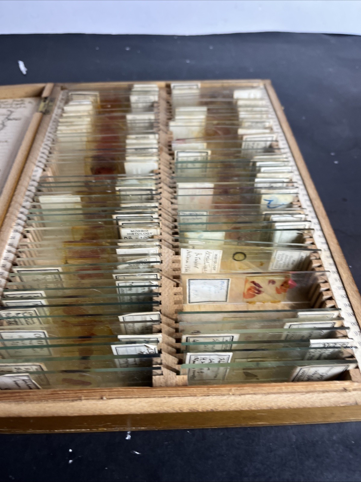 Antique 1936 University of Edinburgh Histology Microscope Slide Set Case 83