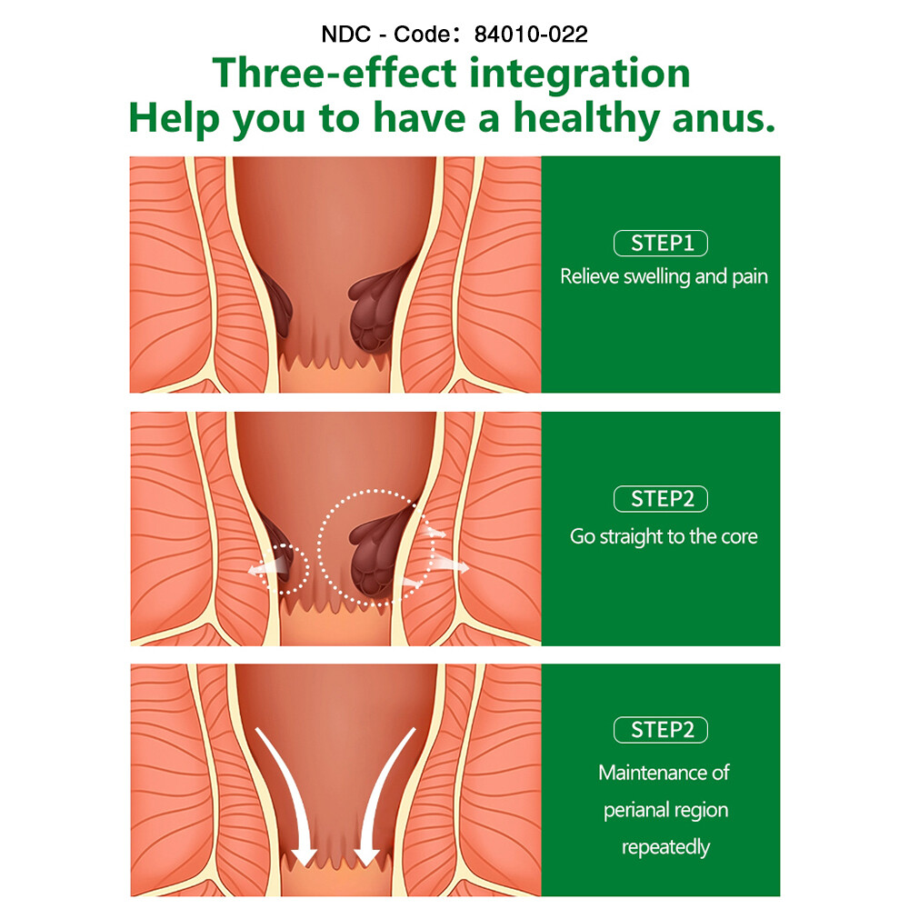 Hemorrhoid Cream, Hemorrhoid Treatment, Hemorrhoid & Fissure Ointment, Fast