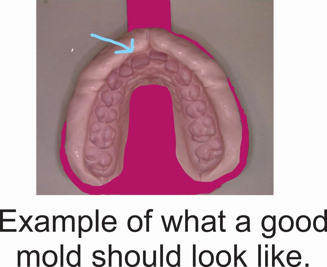 Teeth Molding Impression Kit- Recommended to be used by our current clients