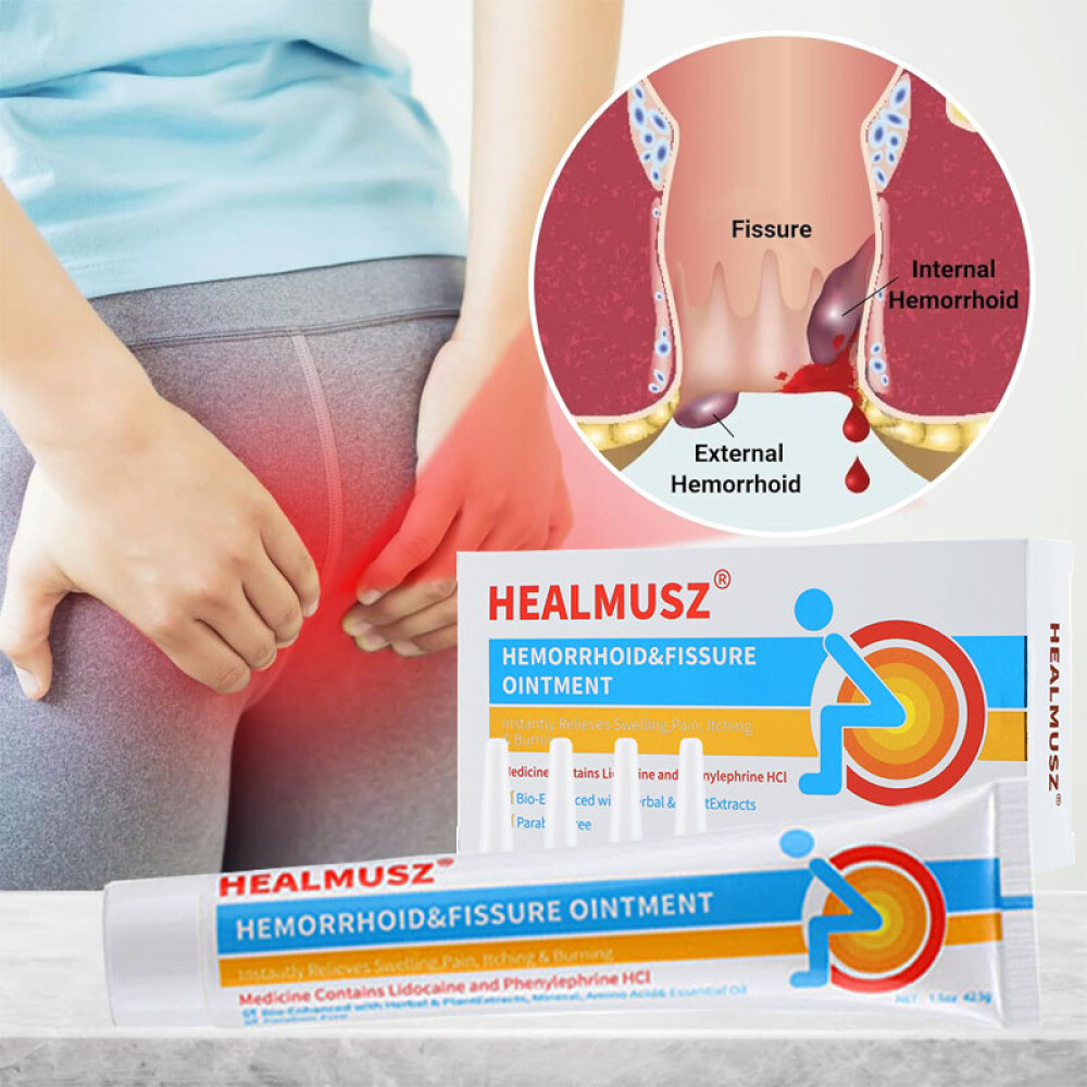 Hemorrhoids Remove Ointment Herbal Cream Relief Piles Pain Reduce Itching 42.5g