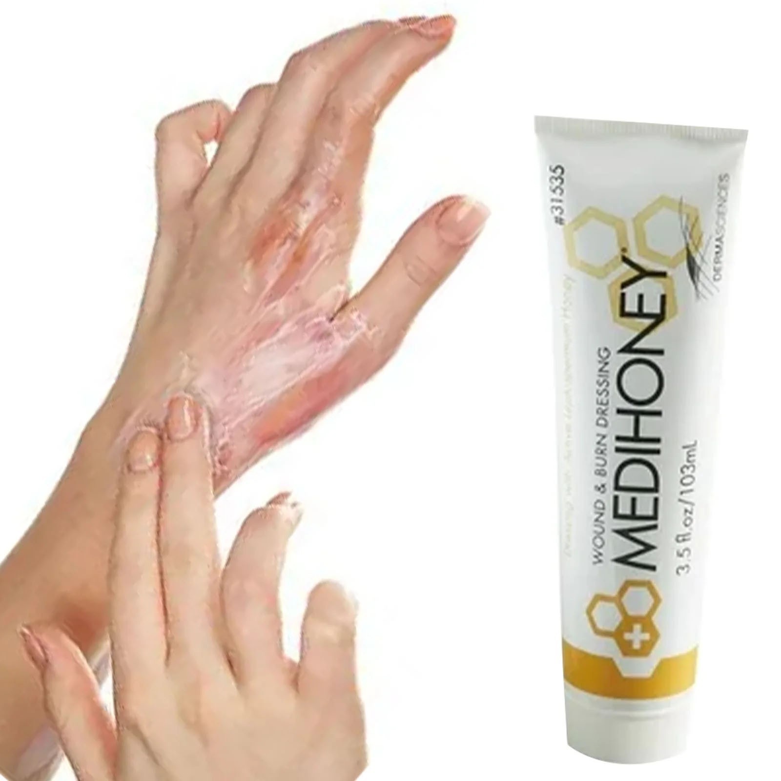 100ML MEDIHONEY Gel Wound & Burn Dressing Tube 3.5 oz GEL Non-Adhesive