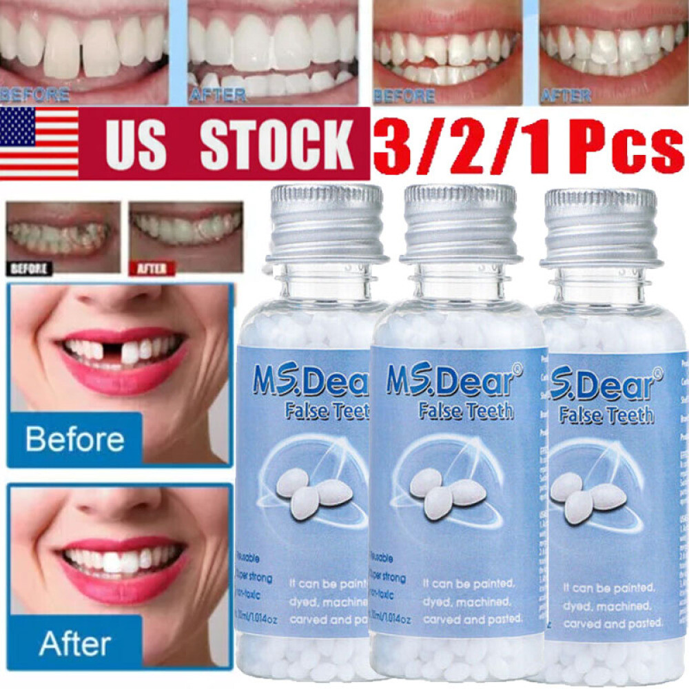 3/2X Tooth Repair Granules Temporary Fitting Beads Reusable Moldable False Teeth